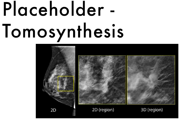 Mammography placeholder tomosynthesis